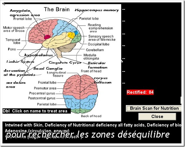 Scintigraphie du cerveau
